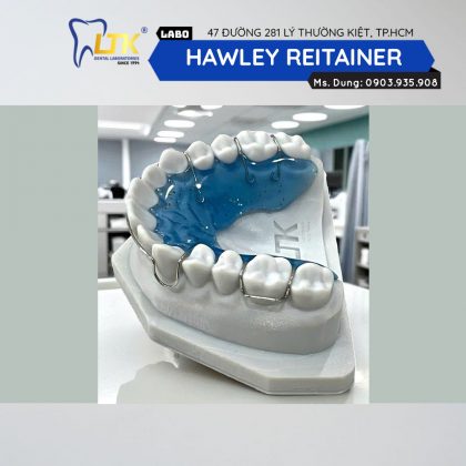 Hawley Retainer
