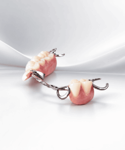 Cast Partial Dentures