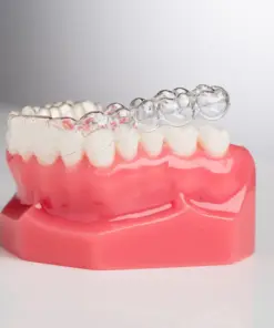 Clear Aligner