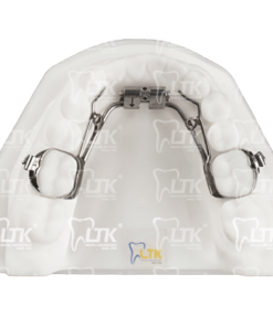 Rapid Molar Distalizer