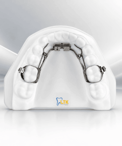 Rapid Molar Distalizer