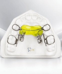 Molar Distal Jet