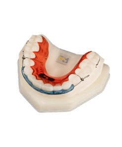 Anterior Space Closing Ret