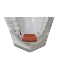 Fixed Retainer