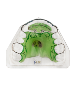 Spring Retainer