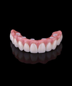 Cầu răng toàn sứ zirconia cố định trên implant