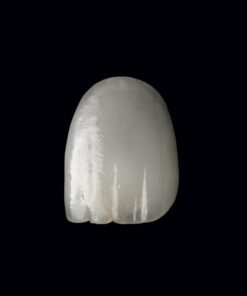 Veneers