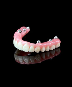 Hybrid Implant Dentures