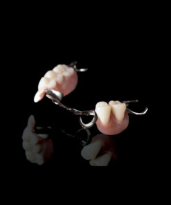 Cast Partial Dentures