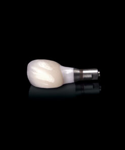 IMPLANT RESTORATIONS