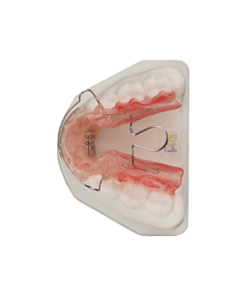 Bionator II (To Close)