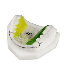 MOD Retainer