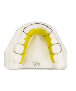 Hawley Retainer - Lower FIXX