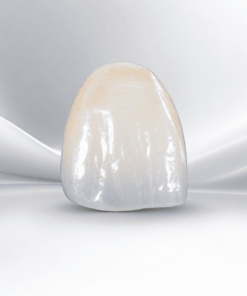 Veneers