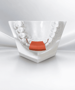 Fixed Retainer