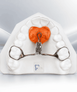 Fixed Sagittal
