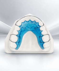 Hawley with Anterior bite plate